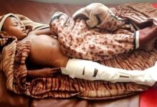 A child receives care at a hospital in Dedebit after reported airstrike