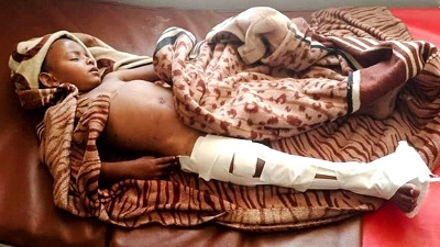 A child receives care at a hospital in Dedebit after reported airstrike