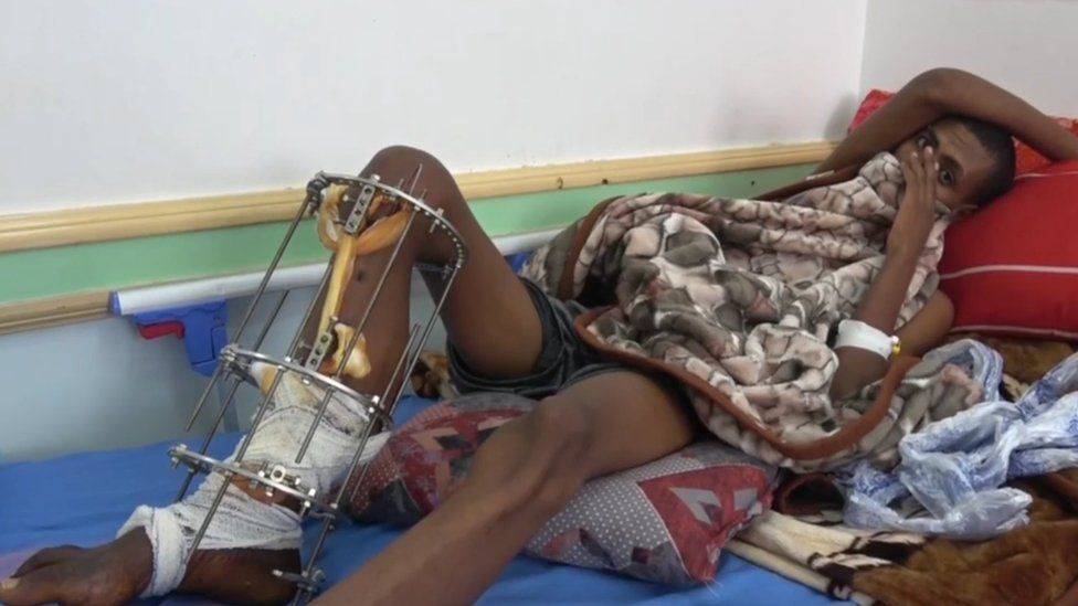 • Ethiopian migrants say they were shot when they tried to cross from Yemen into Saudi Arabia